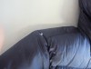 【Before】肩穴