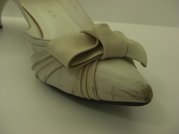 【Before】トゥのキズ