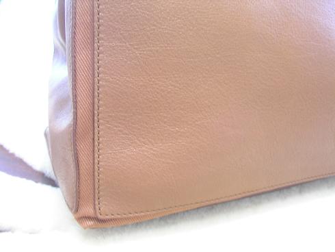 【After】ボールペン跡