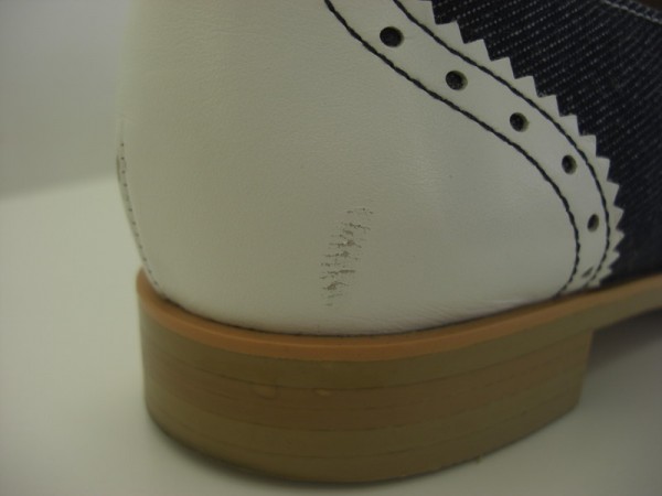 かかと傷【Before】