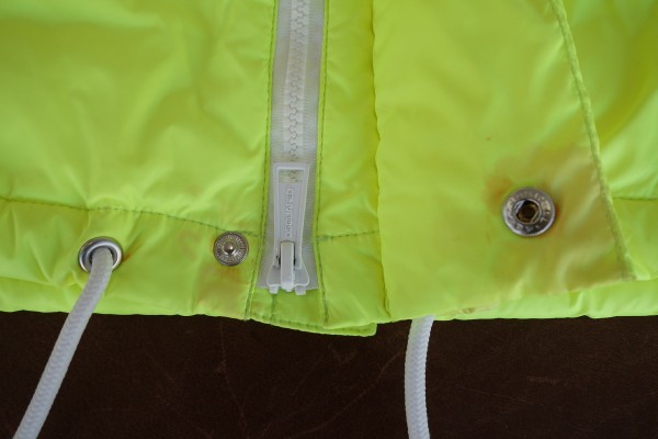 【Before】