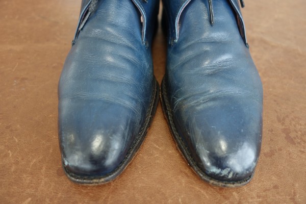 【Before】つま先