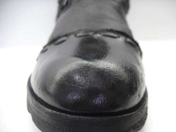 【After】つま先のキズ