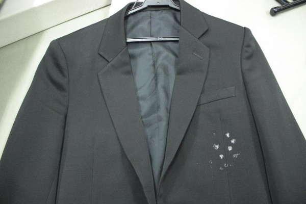 【Before】