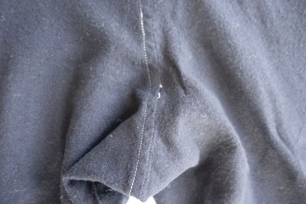 【Before】糸ゆるみ